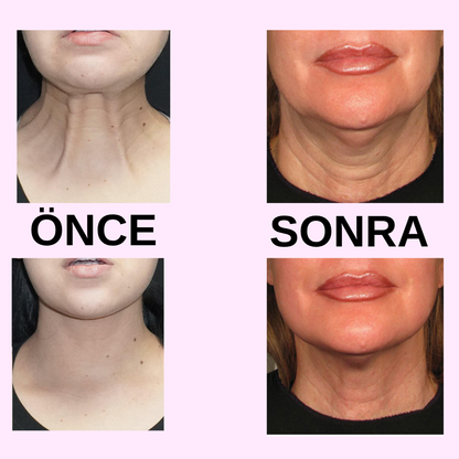 Gold Boyun Kolajen Maskesi